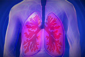 Интенсивная терапия дыхательной недостаточности