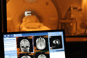 Нейрофизиологические методы обследования головного мозга: ЭЭГ и ЭхоЭГ